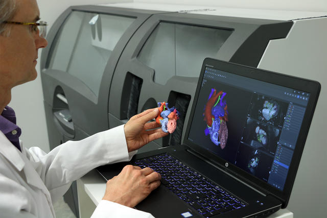 3D Systems informa que su software D2P permite a los médicos imprimir 3D un modelo específico anatómico de pacientes para el diagnóstico