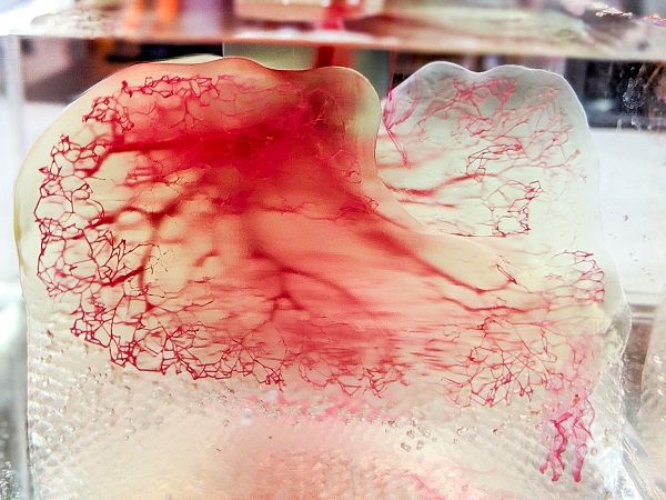 Modelo de vascular humano creado en el proceso Print to Perfusion (Imagen cortesía de United Therapeutics)