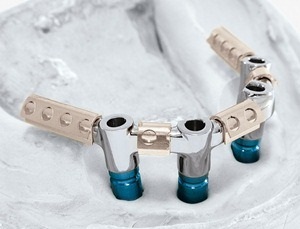 Lab Dental