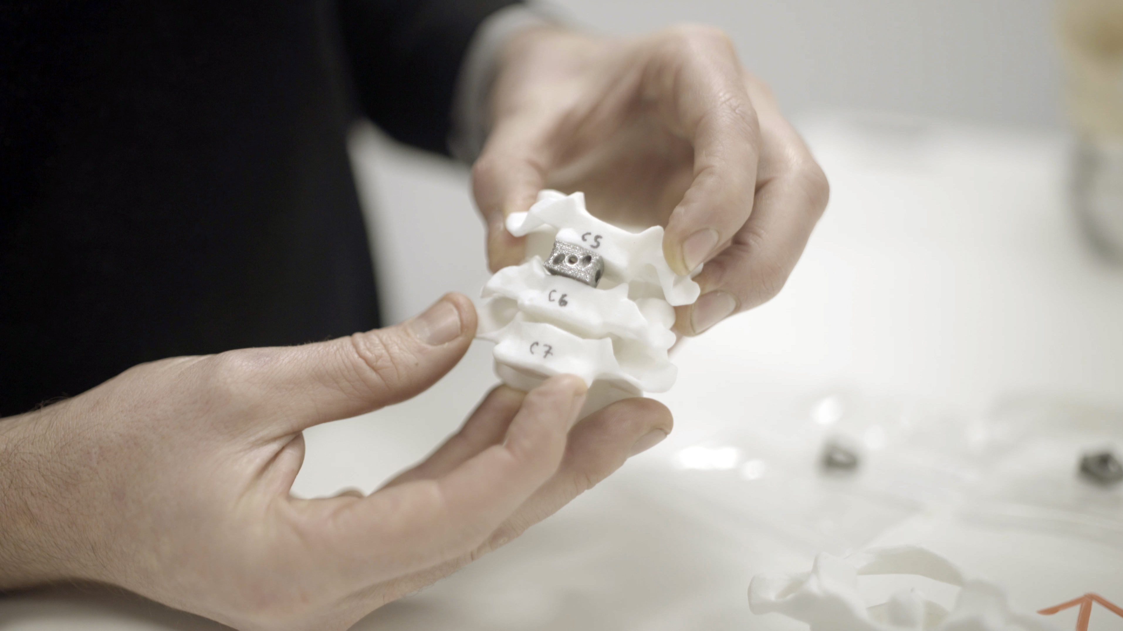 Renishaw demuestra las capacidades de la manufactura aditiva en implantes de columna