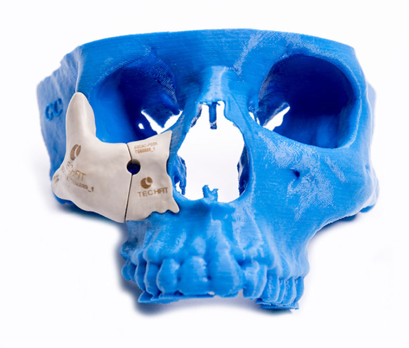 Techfit es una empresa colombiana que ofrece soluciones quirúrgicas a la medida de la mano de la  tecnología en manufactura aditiva de Stratasys