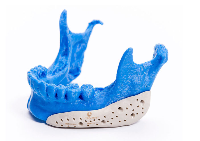 Techfit es una empresa colombiana que ofrece soluciones quirúrgicas a la medida de la mano de la  tecnología en manufactura aditiva de Stratasys